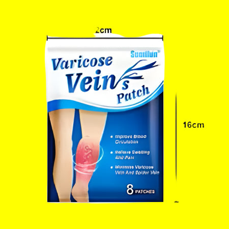 Varicose Veins – Overview
