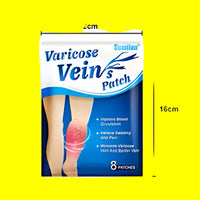 Varicose Veins – Overview