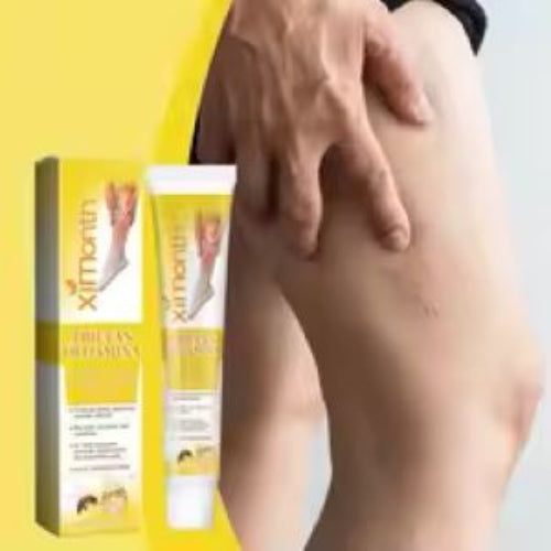 "varicose vein ointment