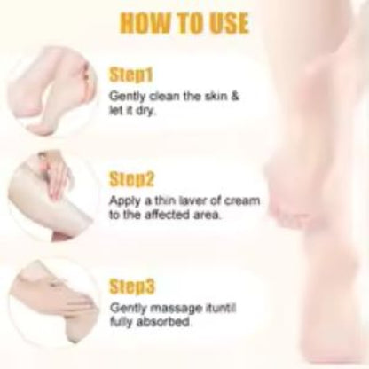 Varicose Vein Relief Cream